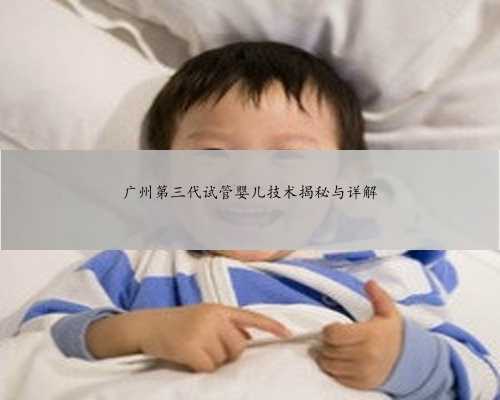 广州第三代试管婴儿技术揭秘与详解
